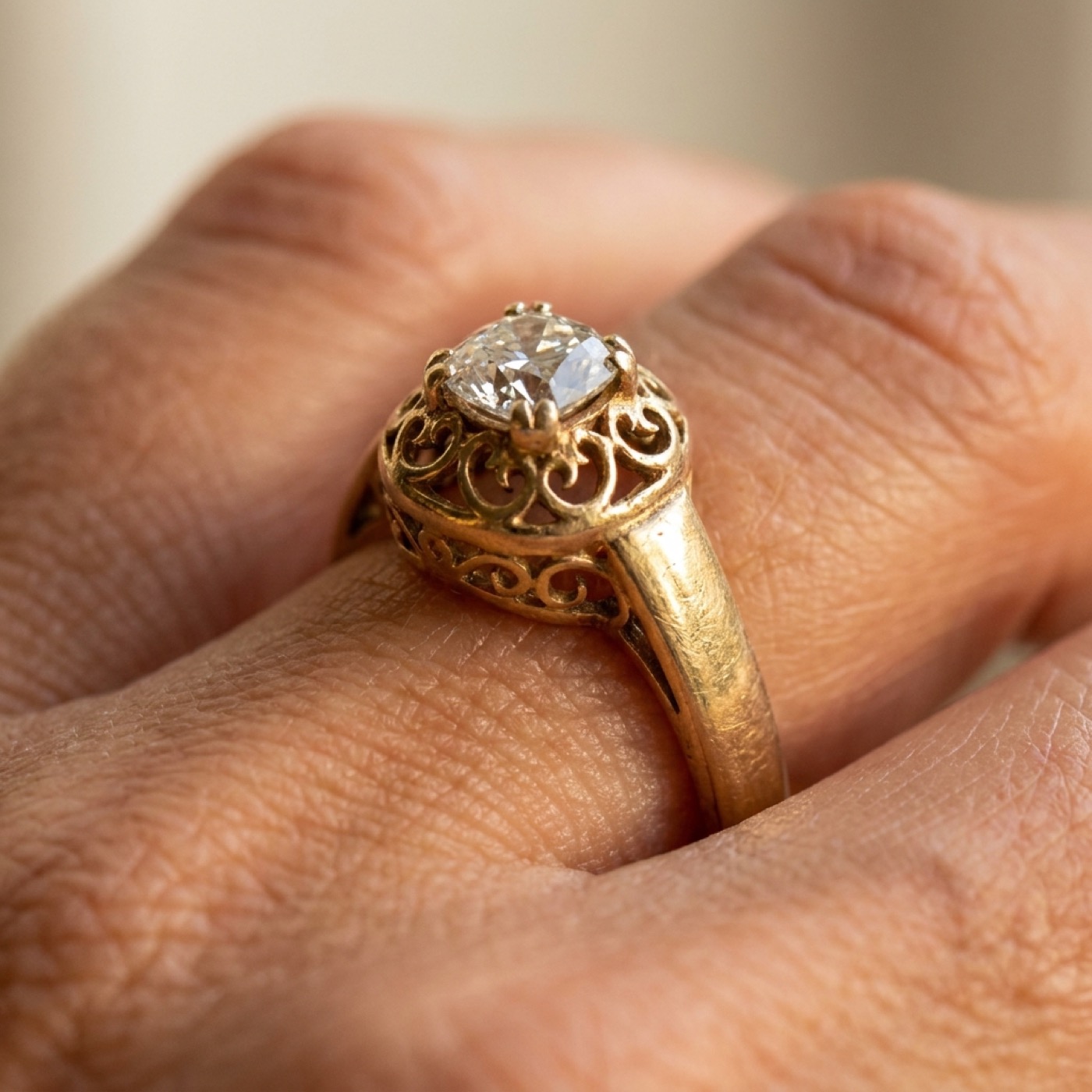 Dated ring setting before restoration